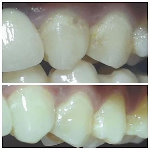 Pooja Smile Care Dental Gallery Image 26